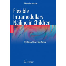 Flexible Intramedullary Nailing in Children: The Nancy University Manual