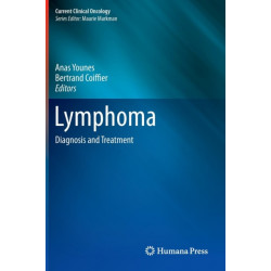 Lymphoma: Diagnosis and Treatment