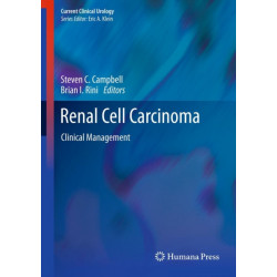 Renal Cell Carcinoma: Clinical Management