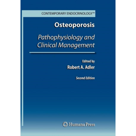 Osteoporosis: Pathophysiology and Clinical Management