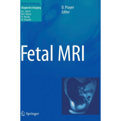 Fetal MRI