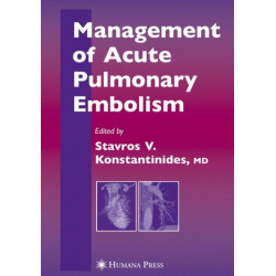 Management of Acute Pulmonary Embolism