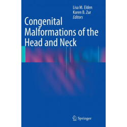 Congenital Malformations of the Head and Neck