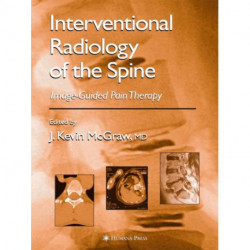 Interventional Radiology of the Spine: Image-Guided Pain Therapy