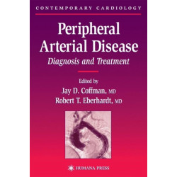 Peripheral Arterial Disease: Diagnosis and Treatment