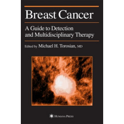 Breast Cancer: A Guide to Detection and Multidisciplinary Therapy