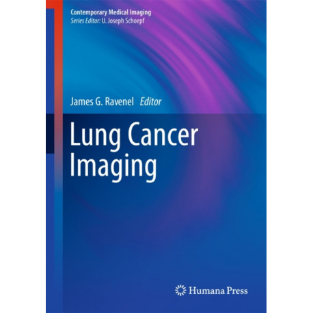 Lung Cancer Imaging