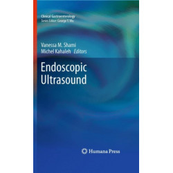 Endoscopic Ultrasound
