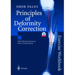 Principles of Deformity Correction: Exercise Workbook