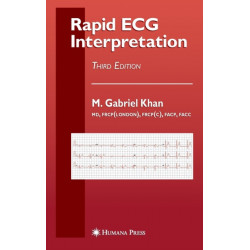 Rapid ECG Interpretation