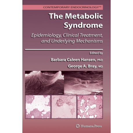 The Metabolic Syndrome:: Epidemiology, Clinical Treatment, and Underlying Mechanisms