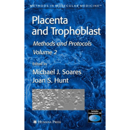 Placenta and Trophoblast: Methods and Protocols, Volume II