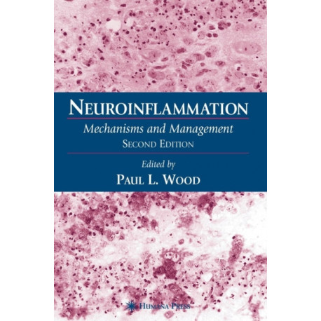 Neuroinflammation: Mechanisms and Management