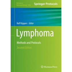Lymphoma: Methods and Protocols