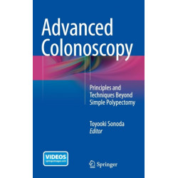 Advanced Colonoscopy: Principles and Techniques Beyond Simple Polypectomy