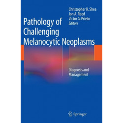 Pathology of Challenging Melanocytic Neoplasms: Diagnosis and Management
