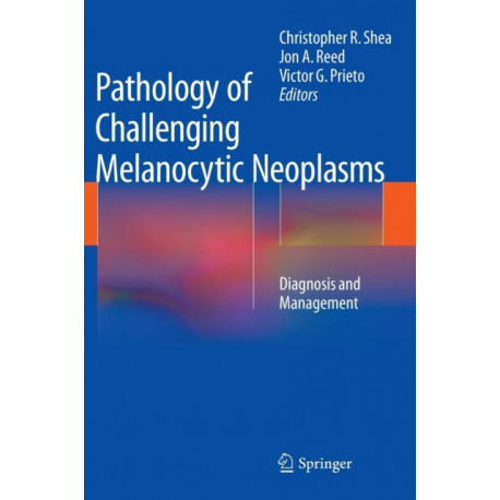 Pathology of Challenging Melanocytic Neoplasms: Diagnosis and Management