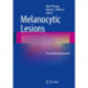 Melanocytic Lesions: A Case Based Approach