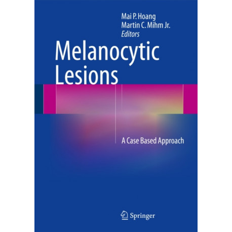 Melanocytic Lesions: A Case Based Approach