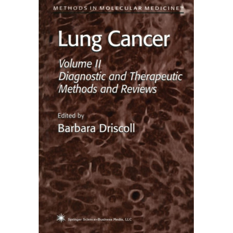 Lung Cancer: Volume 2: Diagnostic and Therapeutic Methods and Reviews