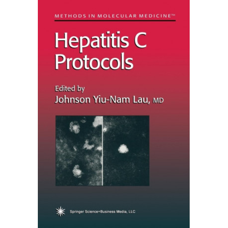 Hepatitis C Protocols