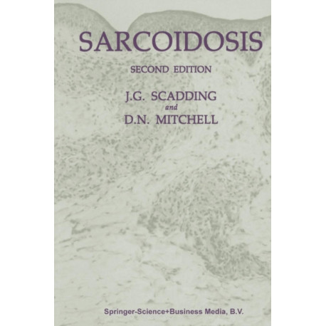 Sarcoidosis