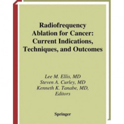 Radiofrequency Ablation for Cancer: Current Indications, Techniques, and Outcomes