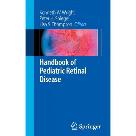 Handbook of Pediatric Retinal Disease