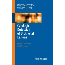 Cytologic Detection of Urothelial Lesions
