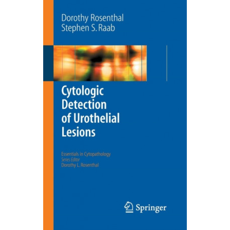 Cytologic Detection of Urothelial Lesions