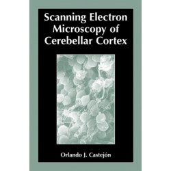 Scanning Electron Microscopy of Cerebellar Cortex