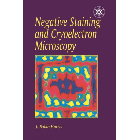 Negative Staining and Cryoelectron Microscopy: The Thin Film Techniques