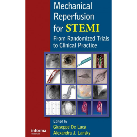 Mechanical Reperfusion for STEMI: From Randomized Trials to Clinical Practice
