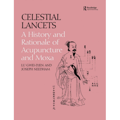 Celestial Lancets: A History and Rationale of Acupuncture and Moxa
