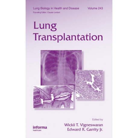 Lung Transplantation