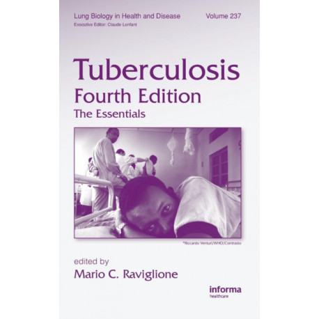 Tuberculosis: The Essentials, Fourth Edition