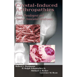 Crystal-Induced Arthropathies: Gout, Pseudogout and Apatite-Associated Syndromes
