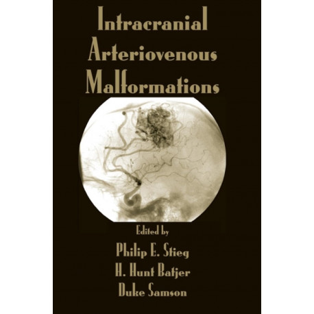 Intracranial Arteriovenous Malformations