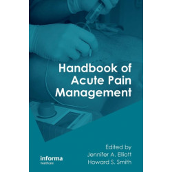 Handbook of Acute Pain Management