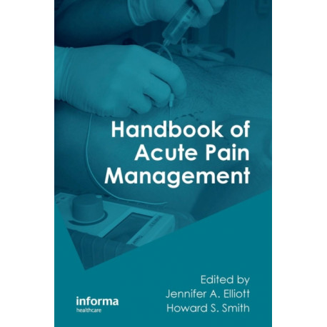 Handbook of Acute Pain Management