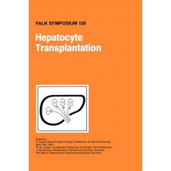 Hepatocyte Transplantation