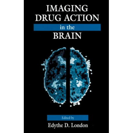 Imaging Drug Action in the Brain
