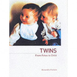 Twins - From Fetus to Child
