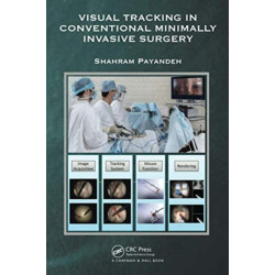 Visual Tracking in Conventional Minimally Invasive Surgery