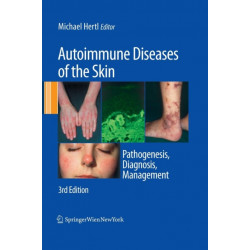 Autoimmune Diseases of the Skin: Pathogenesis, Diagnosis, Management
