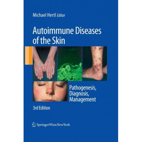 Autoimmune Diseases of the Skin: Pathogenesis, Diagnosis, Management