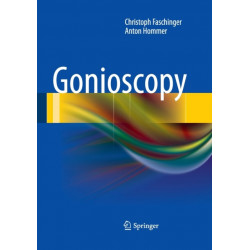 Gonioscopy