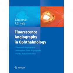 Fluorescence Angiography in Ophthalmology