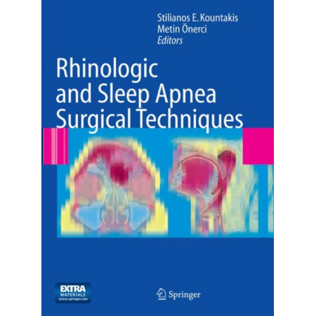 Rhinologic and Sleep Apnea Surgical Techniques