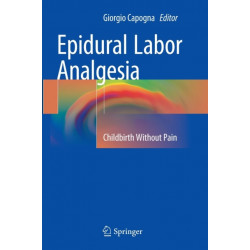 Epidural Labor Analgesia: Childbirth Without Pain